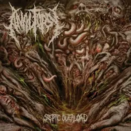 Analtopsy Septic Overload
